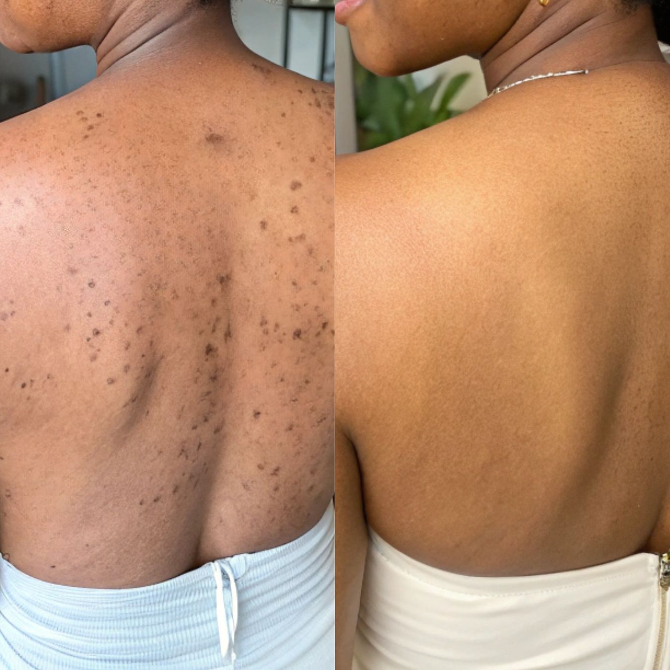 Savon Anti-taches au Curcuma et à l'Acide Kojique