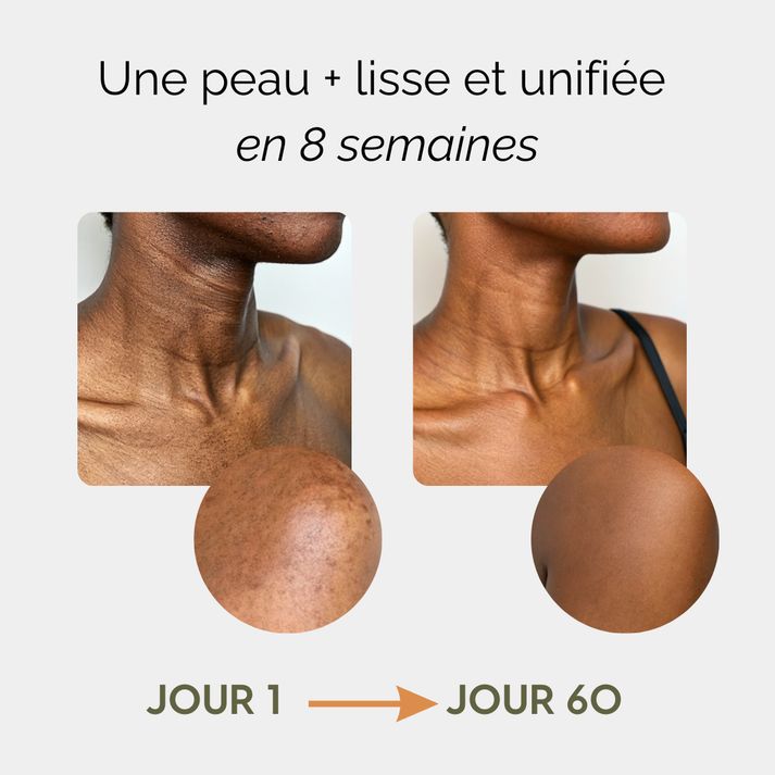 Savon Anti-taches au Curcuma et à l'Acide Kojique