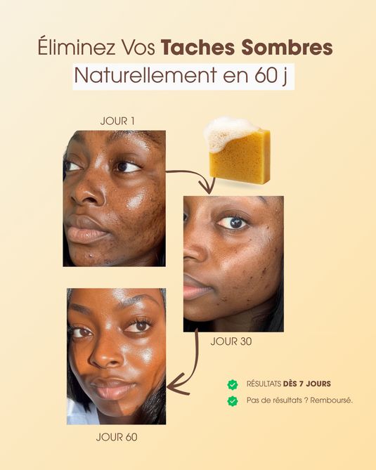 Savon Anti-taches au Curcuma et à l'Acide Kojique