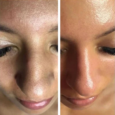 Lanbéna | Masque Dégraissant Anti-Points Noirs