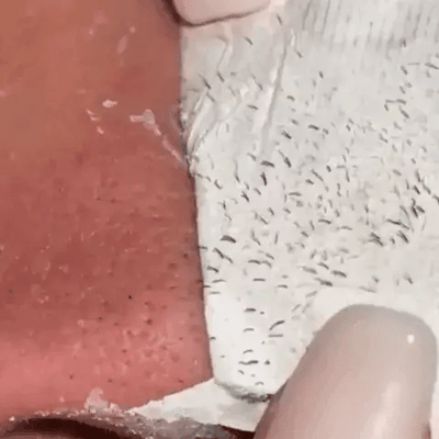 Lanbéna | Masque Dégraissant Anti-Points Noirs